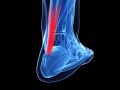 Achilles Tendon Injuries
