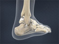 Ankle Sprains