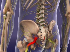 Sciatica Care Salinas