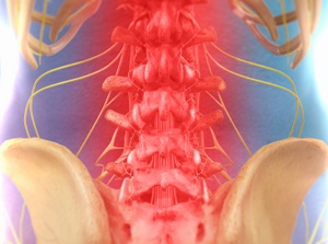 Educational video about Spinal Decompression