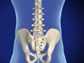 Facet Fixation (US Spine™)