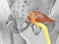Fluoroscopic Guided Piriformis Injection