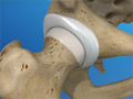 Anatomy of the Hip Joint