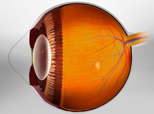 Keratoconus educational video provided by Eye Care and Vision Associates, Ophthalmology, Buffalo, NY