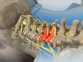 Medial Branch Block (Cervical)