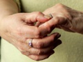Osteoarthritis of the Hand
