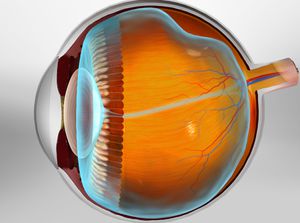 Vitreous Detachment educational video provided by Eye Care and Vision Associates, Ophthalmology, Buffalo, NY