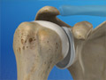 Anatomy of the Shoulder