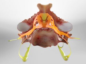 Spinal Stenosis (Cervical) video thumbnail
