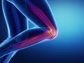 Stem Cell Therapy for Knee Pain