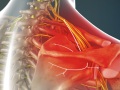 Suprascapular Neuropathy