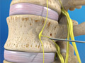 Lumbar Sympathetic Block